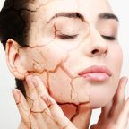 Фото: Какой уход нужен для сухой кожи лица?